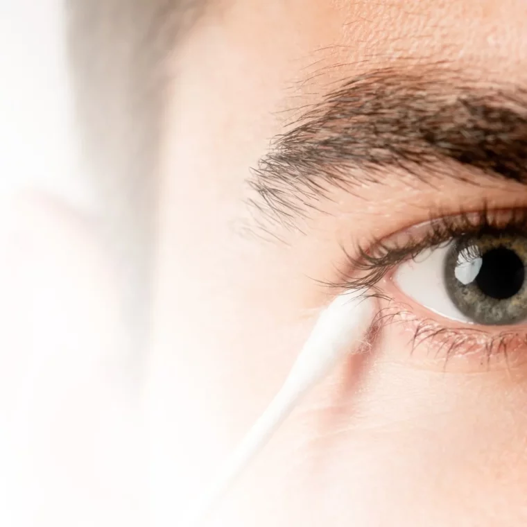 12Lidrandpflege - Trockene Augen - Symptome, Ursachen & Behandlung - Augenärzte Gerl & Kollegen