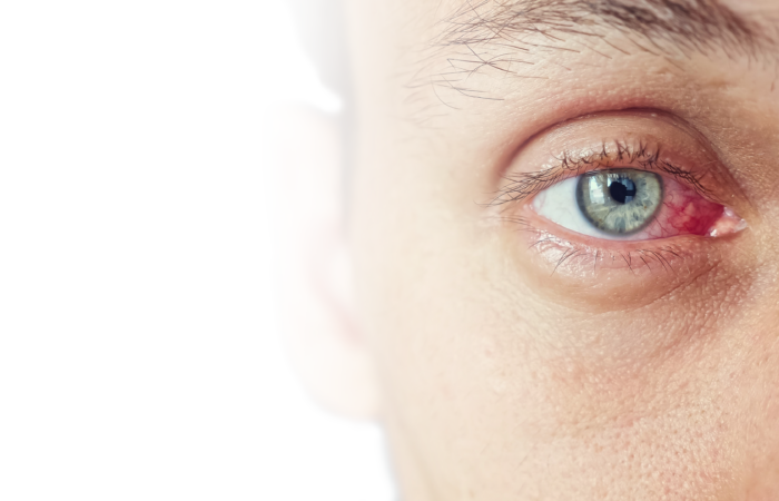 AdobeStock 449491614 final - Erkrankungen - Augenärzte Gerl & Kollegen